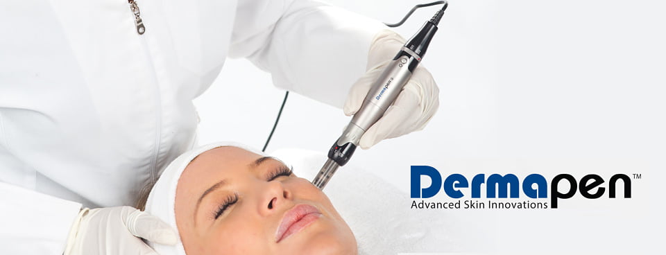 Dermapen Microneedling 3 Dermapen Micro Needling